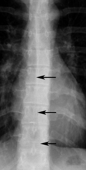 AzyEsop interf
Ex 1 arrows
