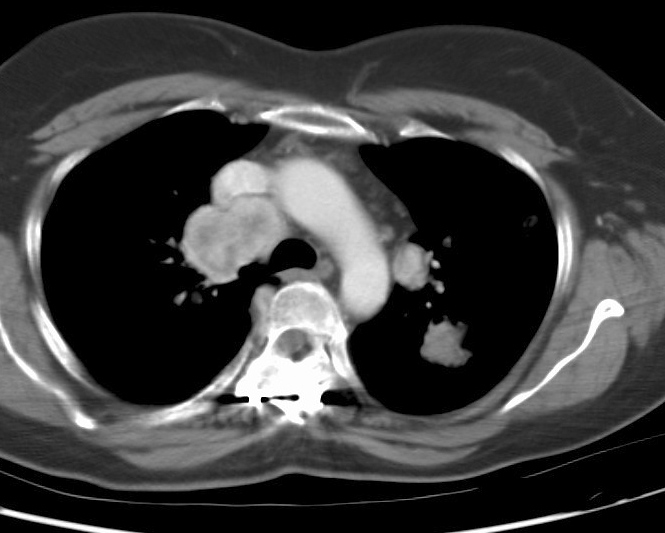 Renal cell