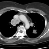 Renal cell