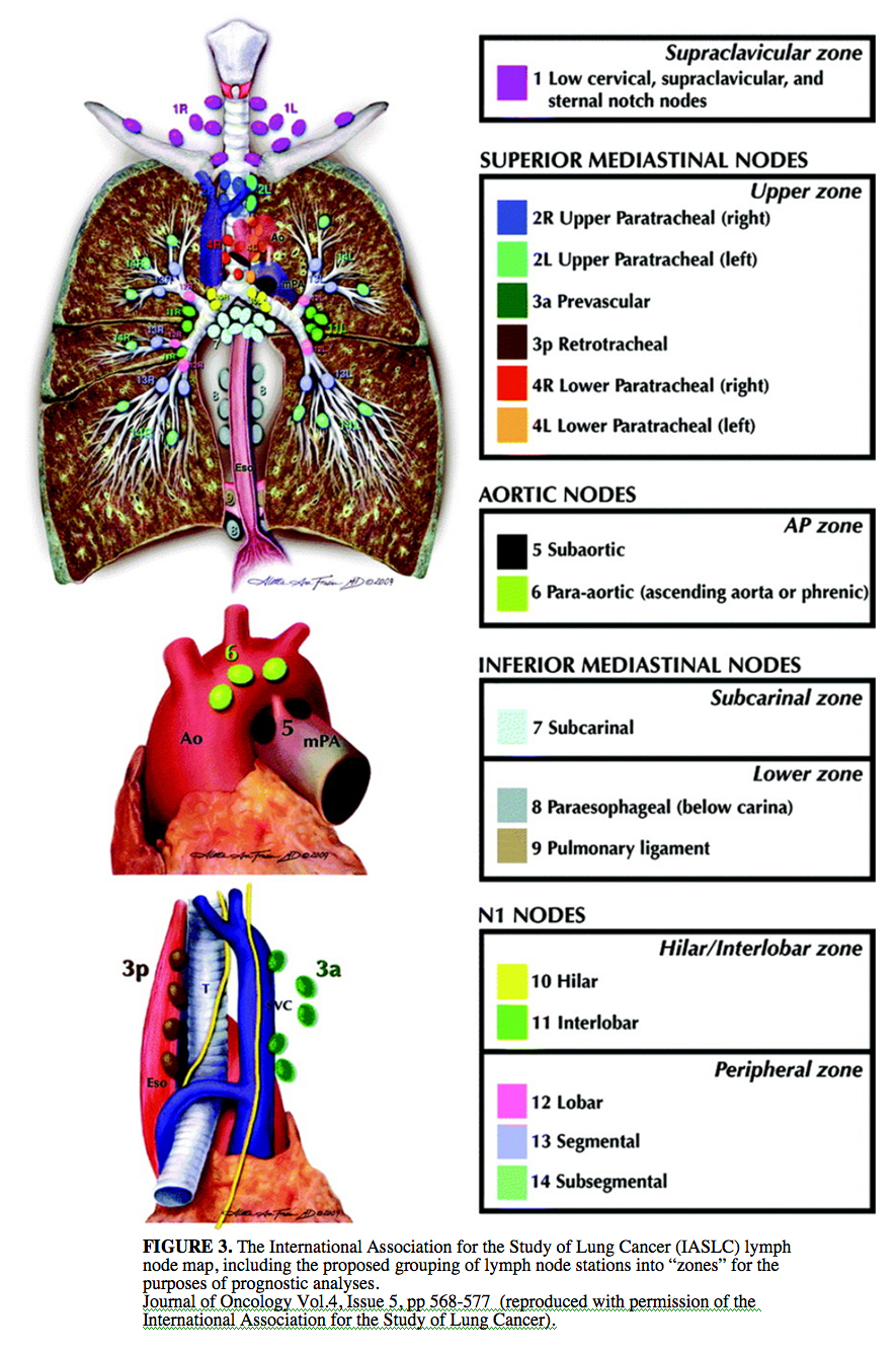 IASLC Lymph Node map and proposed "zones".
(7th proposed TNM class'n)