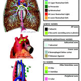 IASLC Lymph Node map and proposed "zones".
(7th proposed TNM class'n)