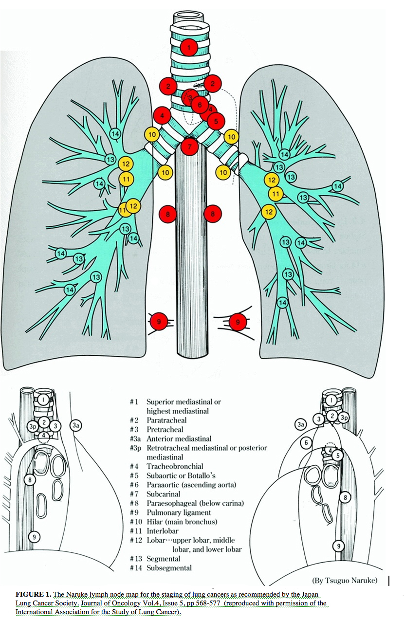 Naruke lymph node map
(Japan Lung Cancer Society)