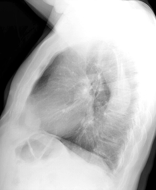 CP angle mass
2b15051695