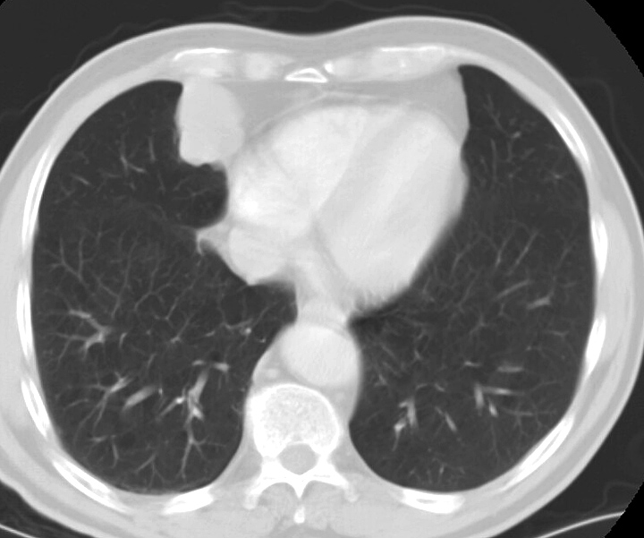 CP angle mass
2c15226093