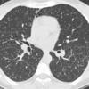 Case 21 CT