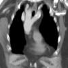 Double arch CT