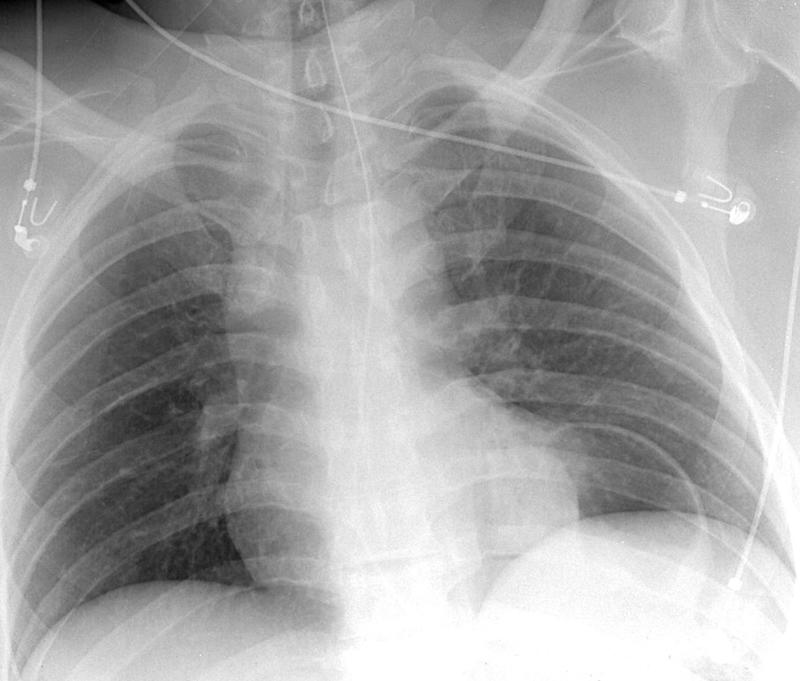 Case 2a