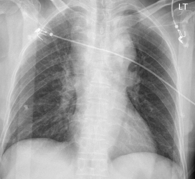 Case 6a