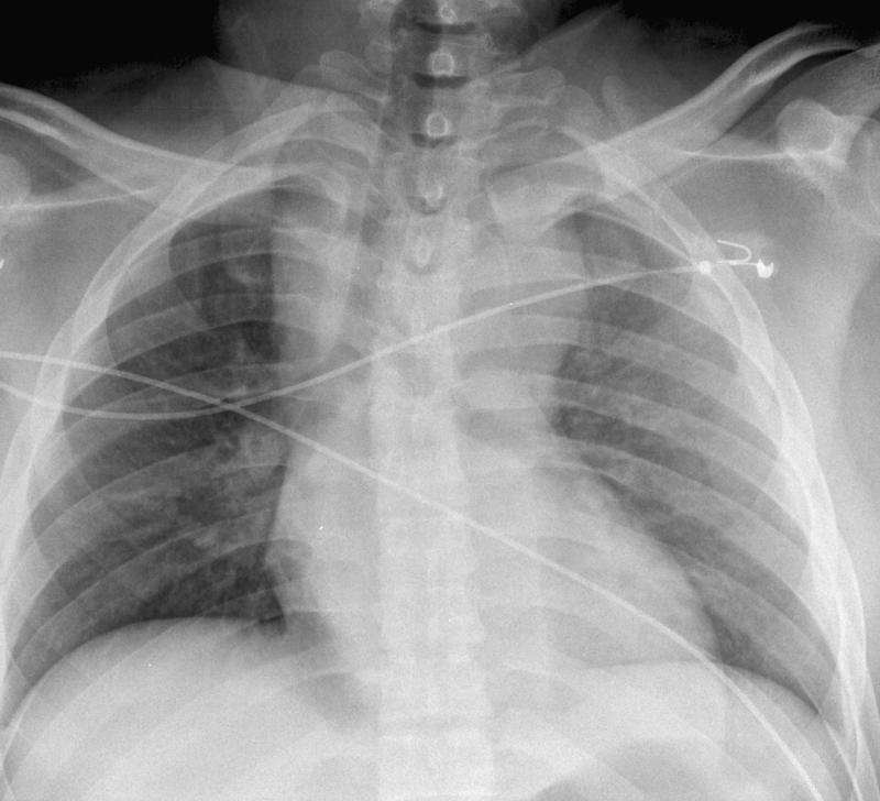 Case 7a