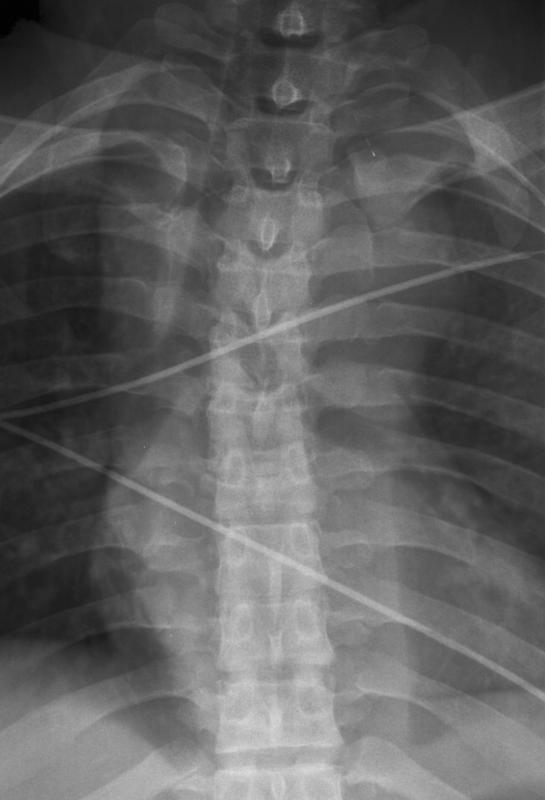 Case 7b