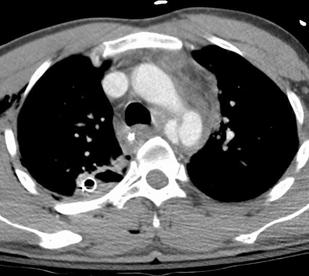 Case 8a