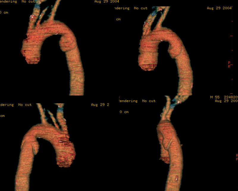 Case 9e
(see Case 11)