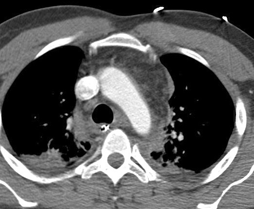 Case 10a