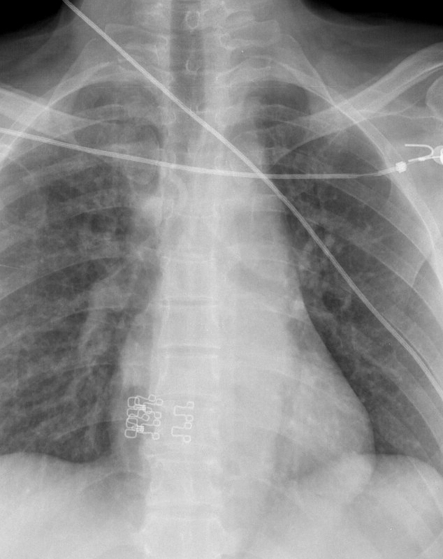 Case 12a